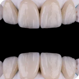 Thẩm mỹ răng sứ