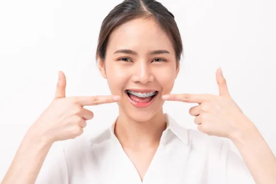Niềng răng để có nụ cười đẹp - Niềng răng ở đâu?