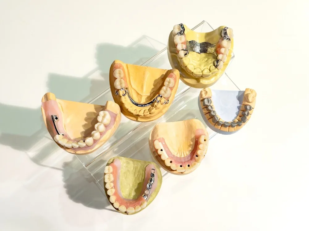 Các loại hàm tháo lắp: hàm nhựa, hàm khung, hàm trên implant tại Long Biên
