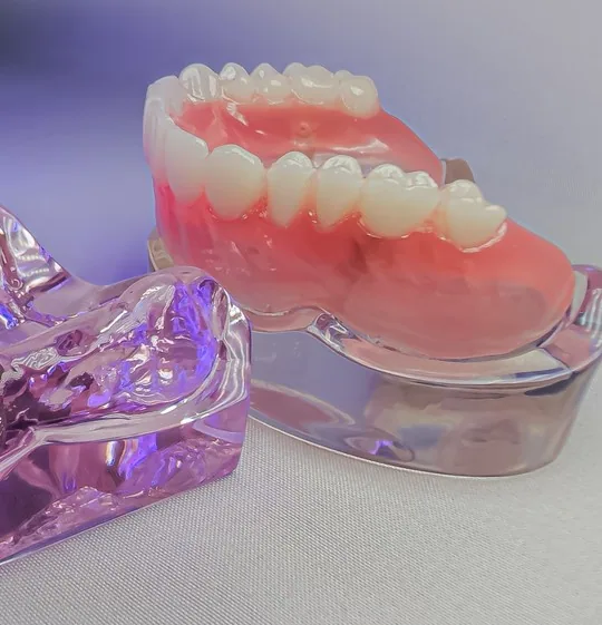 Hàm tháo lắp toàn hàm phục hình răng mất tại Nha khoa Bác sĩ Trung Long Biên