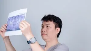 Câu chuyện khách hàng: nhổ răng khôn và lời khuyên đừng để qua tuổi 30
