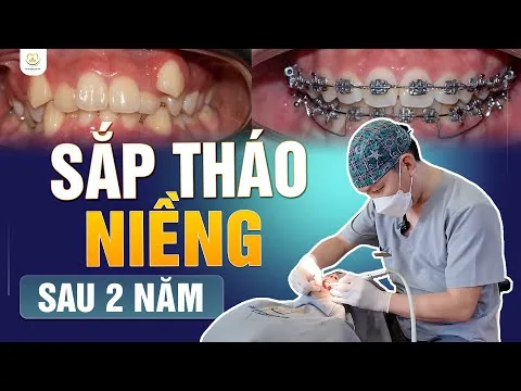 Hành Trình Niềng Răng 2 Năm Và Kết Quả Thực Tế ‑ Nha khoa Bác sĩ Trung Long Biên