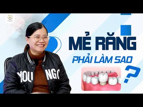 Trải Nghiệm Bọc Răng Sứ Tại Nha Khoa Bác sĩ Trung Long Biên & Cộng Sự ‑ Nha khoa Bác sĩ Trung Long Biên