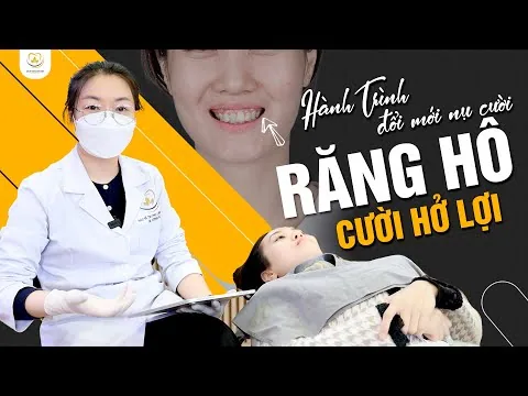 Răng Hô, Cười Hở Lợi Và Hành Trình Lột Xác Nụ Cười Tự Tin ‑ Nha khoa Bác sĩ Trung Long Biên