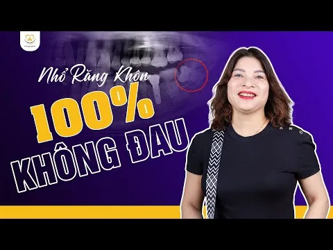 Không Tin Nổi Nhổ Răng Khôn Không Đau: Chị Thu Chia Sẻ Trải Nghiệm ‑ Nha khoa Bác sĩ Trung Long Biên