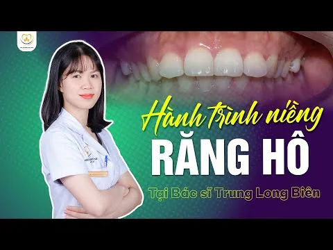 Hành Trình Niềng Răng Hô: Bước Ngoặt Thay Đổi Nụ Cười Của Trà My ‑ Nha khoa Bác sĩ Trung Long Biên