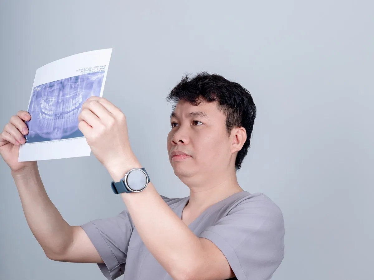 Câu chuyện khách hàng: nhổ răng khôn và lời khuyên đừng để qua tuổi 30