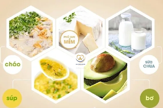 Người mới niềng răng nên ăn gì và không nên ăn gì?