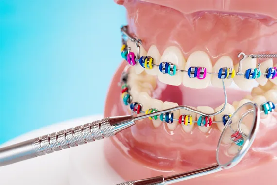 Vấn đề khi niềng răng - Bác sĩ Trung Long Biên