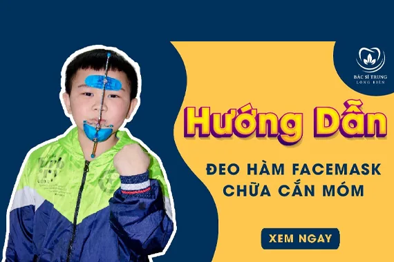Khí cụ hàm Facemask là gì? Đối tượng nào có thể sử dụng?